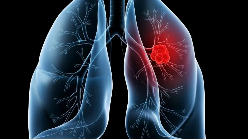 Lung medical hero visual